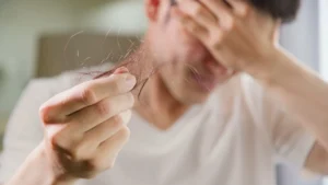 دراسة صينية تكشف عن مخاطر استهلاك المشروبات السكرية على صحة فروة الرأس